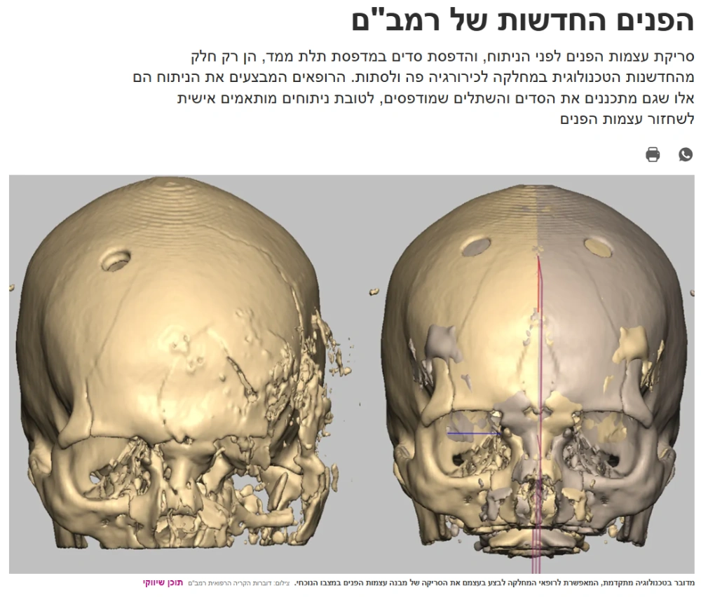 ד״ר טל קפושה מוביל ברמב״ם חדשנות בטכנולוגית תלת מימד בניתוחי חלל הפה והפנים